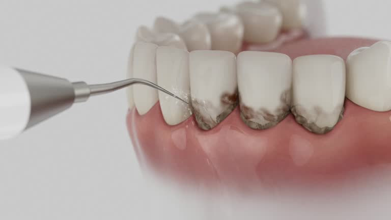 Reliable Dental Implants contractor in Richmond, IN by Smile Center Dentistry